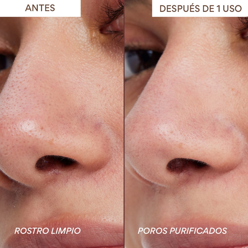 SUPER VOLCANIC PORE DETOXING CLAY MASK WITH AHAS + OIL CONTROL (MASCARILLA DE ARCILLA SUPER VOLC&Aacute;NICA PARA POROS)